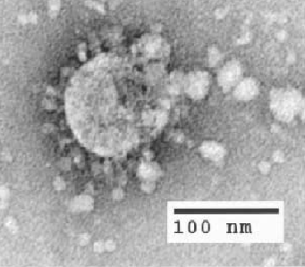 sars s-a-r-s severeacuterespiratorysyndrome - severe acute respiratory syndrome